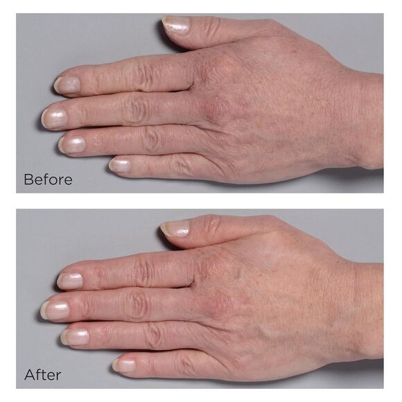 Perricone MD Cold Plasma Plus+ Hand Therapy Hand Treatment 2 fl oz - Picture 3 of 13